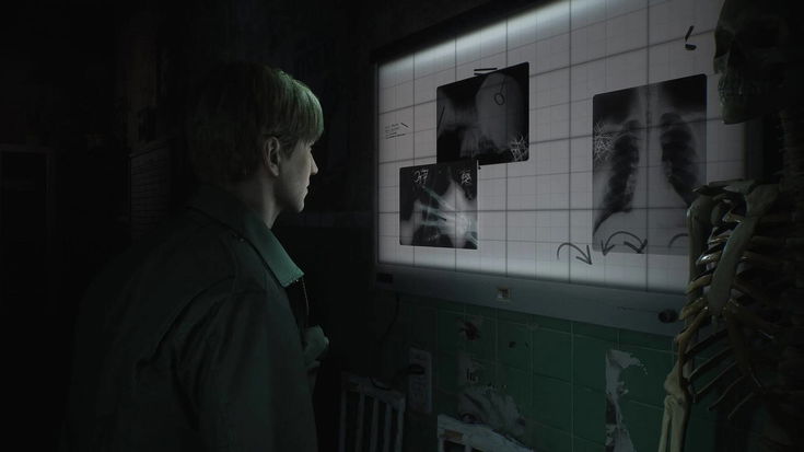 Silent Hill 2 Remake sarà «terrificante» e senza alcun caricamento: ecco tutti i dettagli