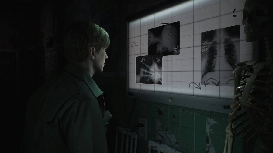 Immagine di Silent Hill 2 Remake sarà «terrificante» e senza alcun caricamento: ecco tutti i dettagli